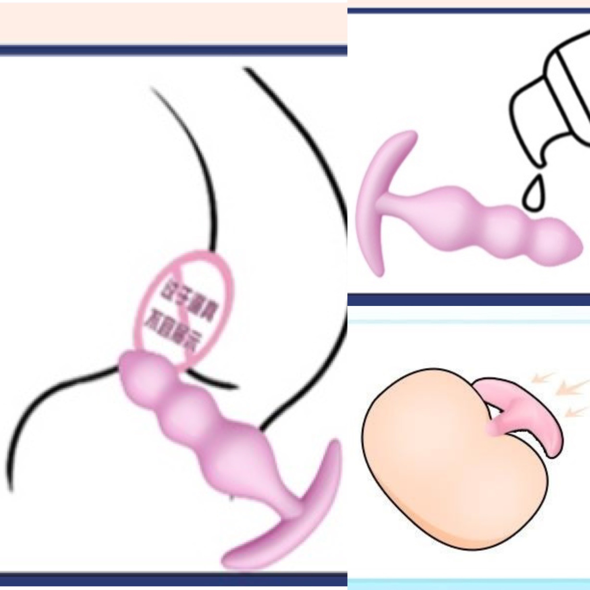 Nút cắm silicone TPE